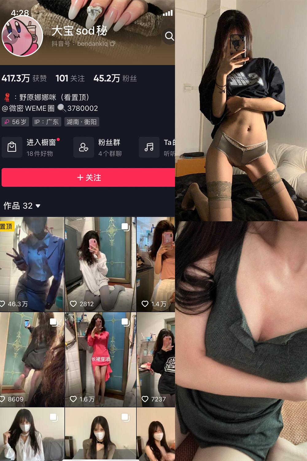 抖音 大宝sod秘 微密圈子分享  NO.011期 【6P5V】