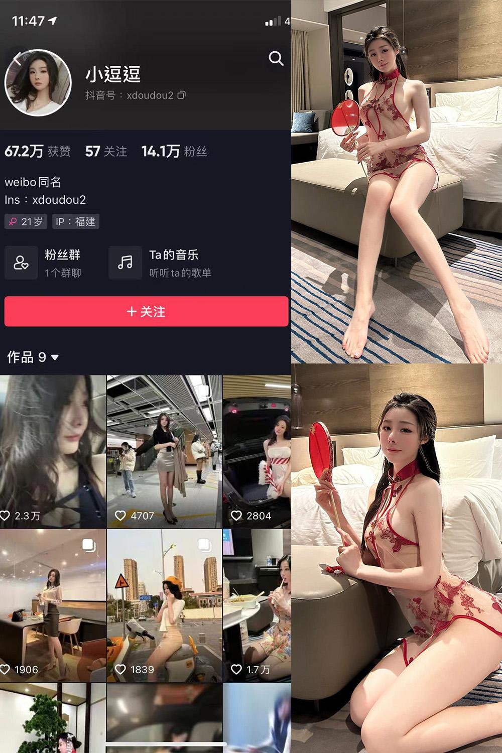 抖音 小逗逗 微密圈子分享  NO.031期 【14P1V】