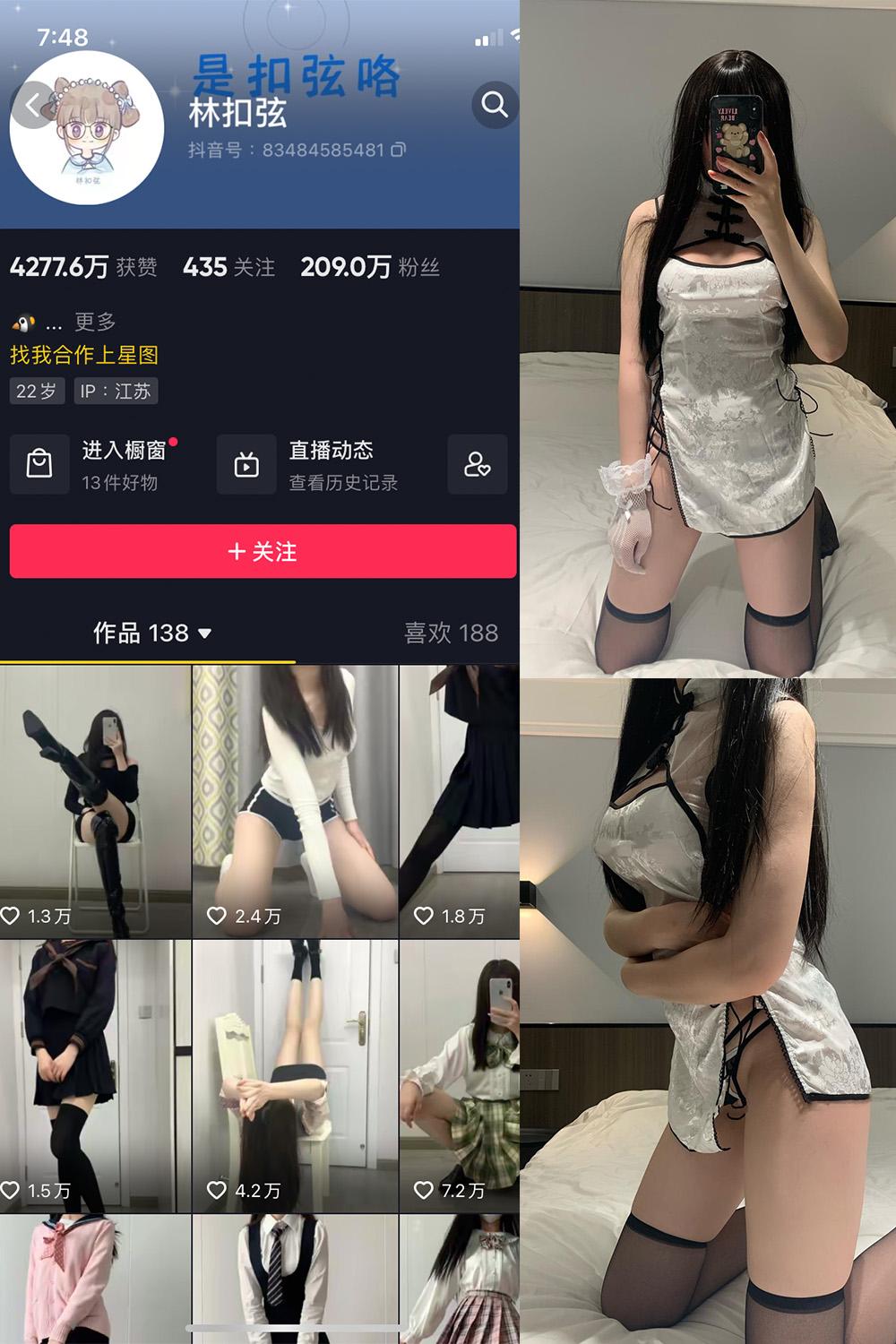 抖音 林扣弦 微密圈子分享 NO.044期 【35P】