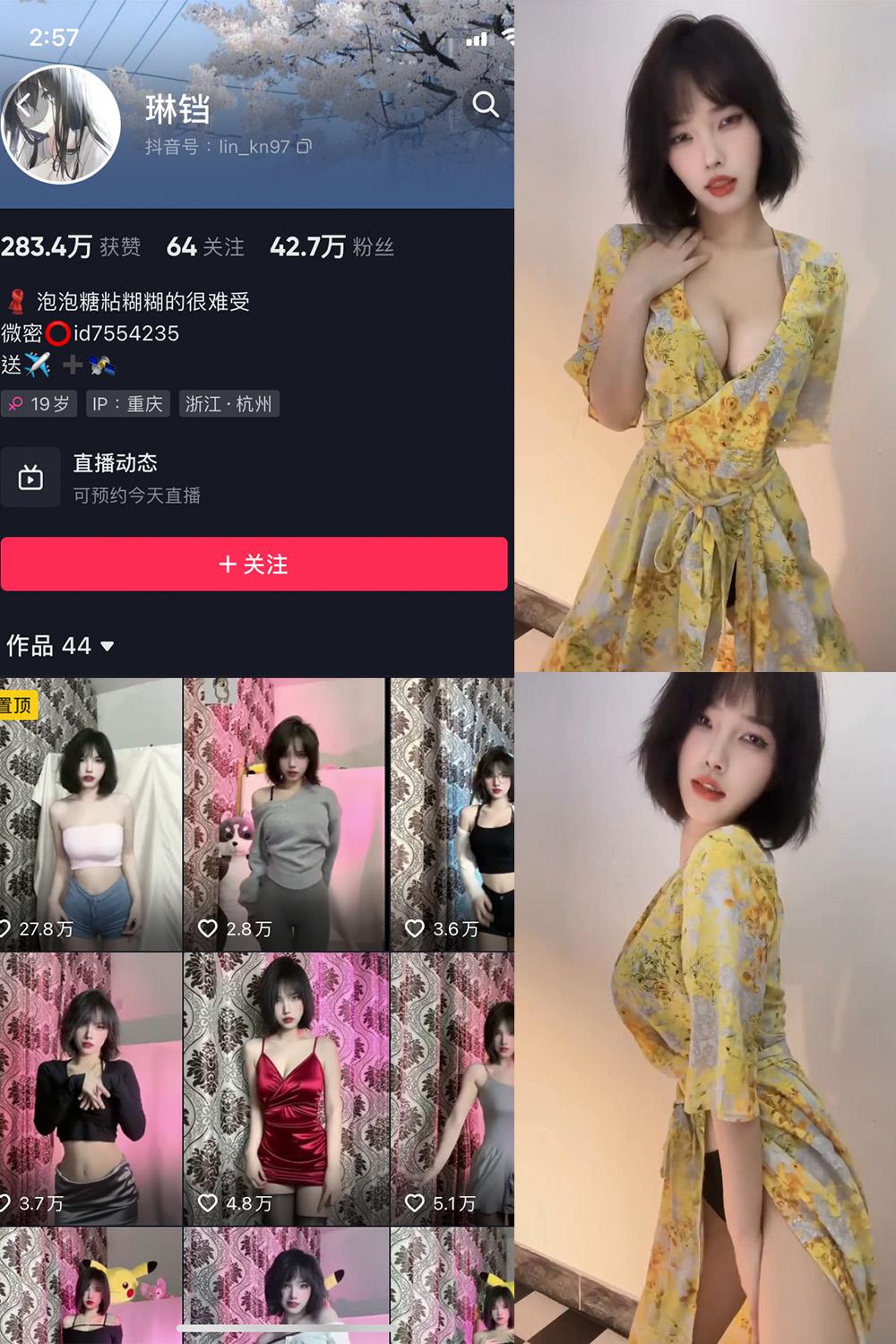 抖音 琳铛 微密圈子分享  NO.016期 【10P3V】