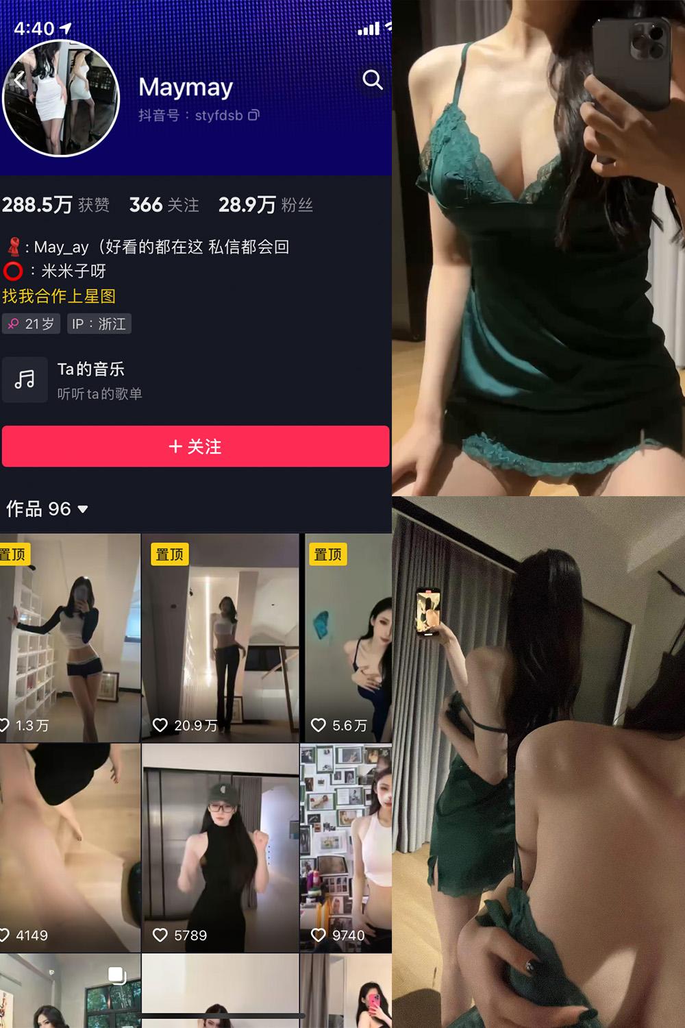 抖音 米米子呀 微密圈子分享 NO.003期 【23P7V】