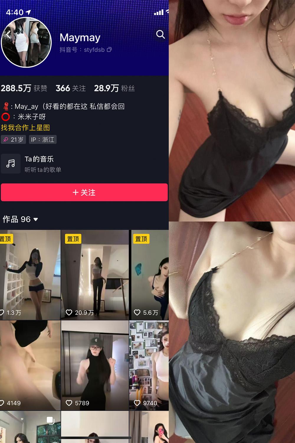 抖音 米米子呀 微密圈子分享 NO.008期 【7P4V】