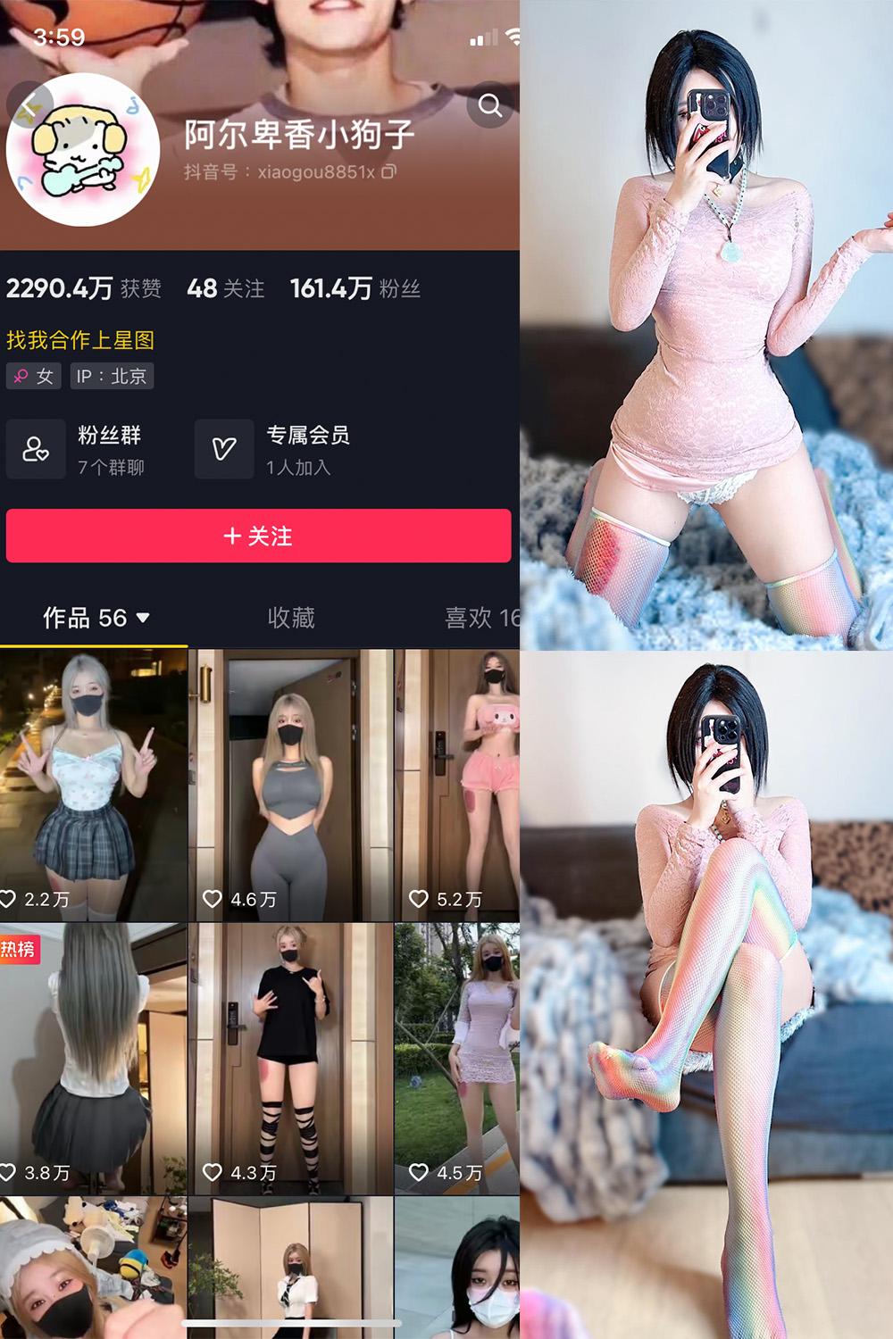 抖音 阿尔卑香小狗子 微密圈子分享  NO.035期 【16P】