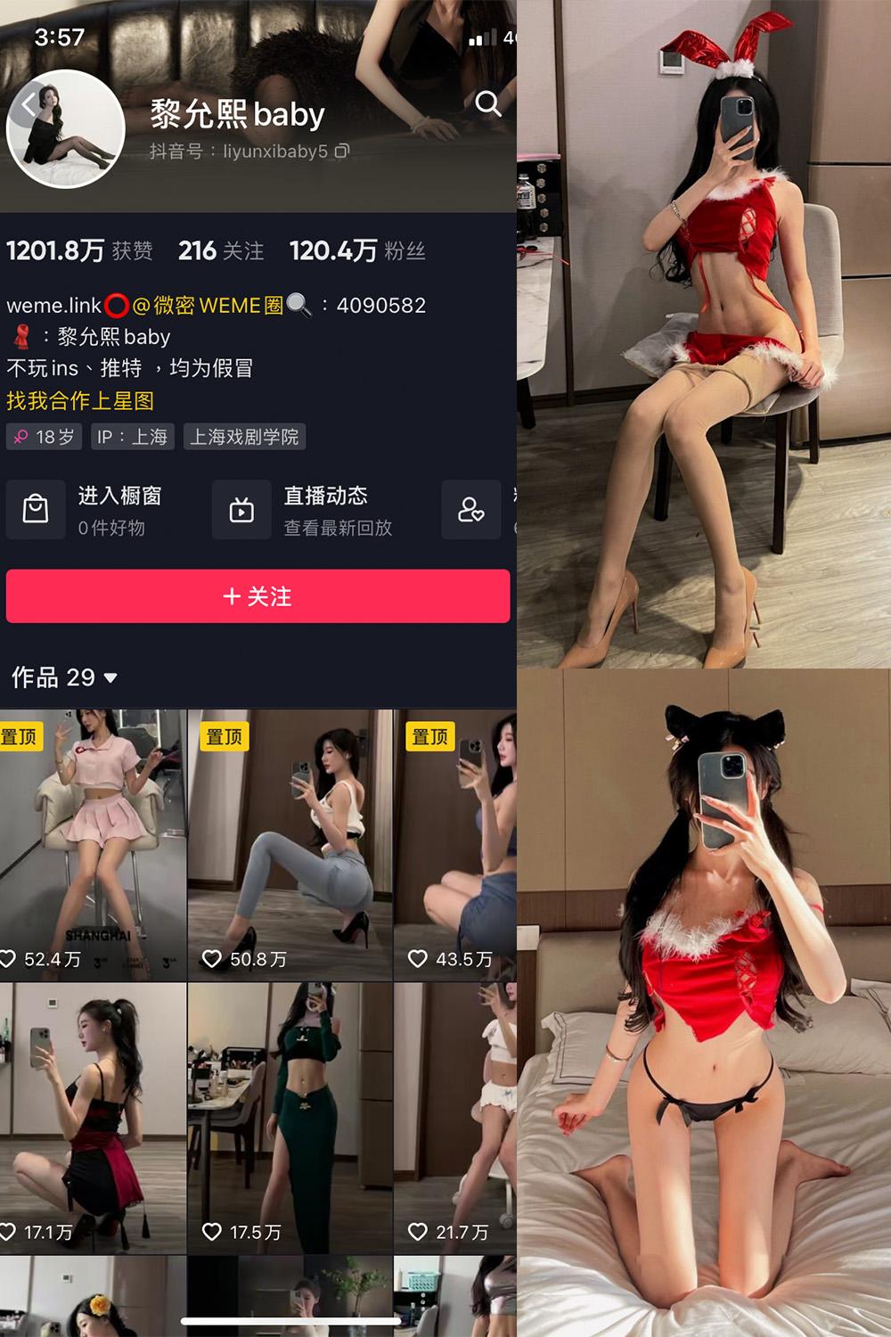 抖音 黎允熙baby 微密圈子分享  NO.007期 【13P】