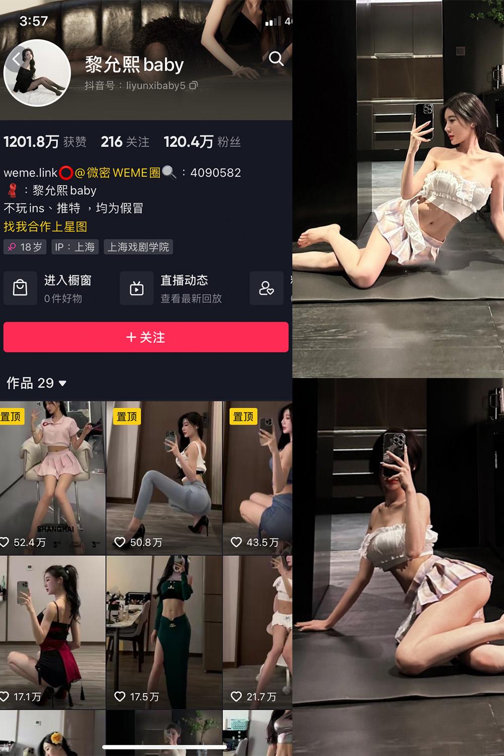 抖音 黎允熙baby 微密圈子分享  NO.008期 【25P】